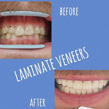 Slider image (4) Park Dental Clinic